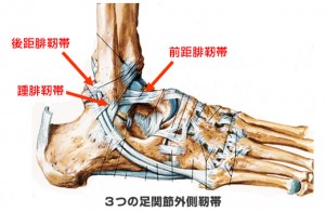 ankle_sprain1